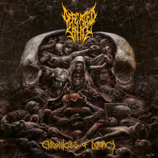 CD / Defeated Sanity / Chronicles Of Lunacy